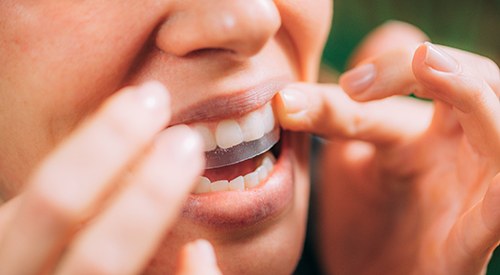 Nose-to-chin closeup of someone applying commercial whitening strip to upper arch of teeth